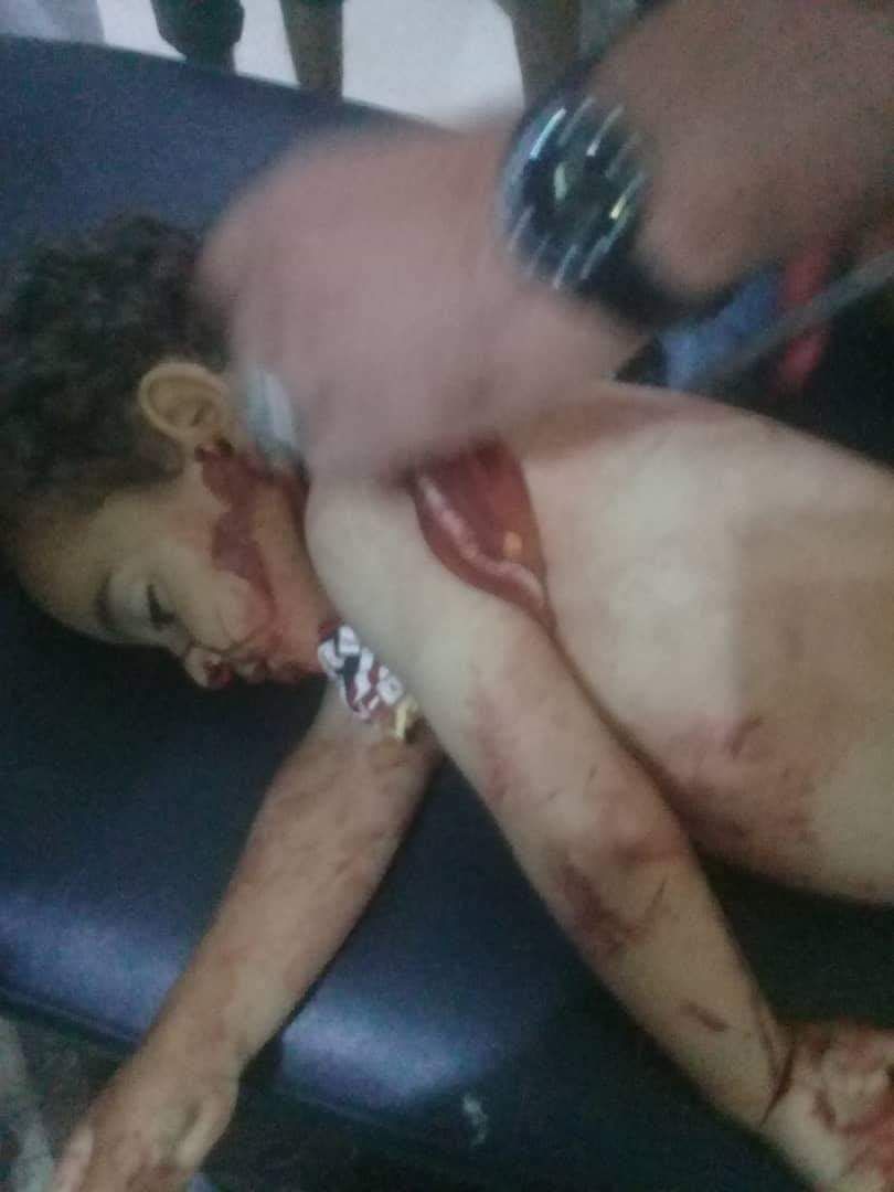 مقتل طفلة برصاص “قسد” بريف دير الزور الشرقي